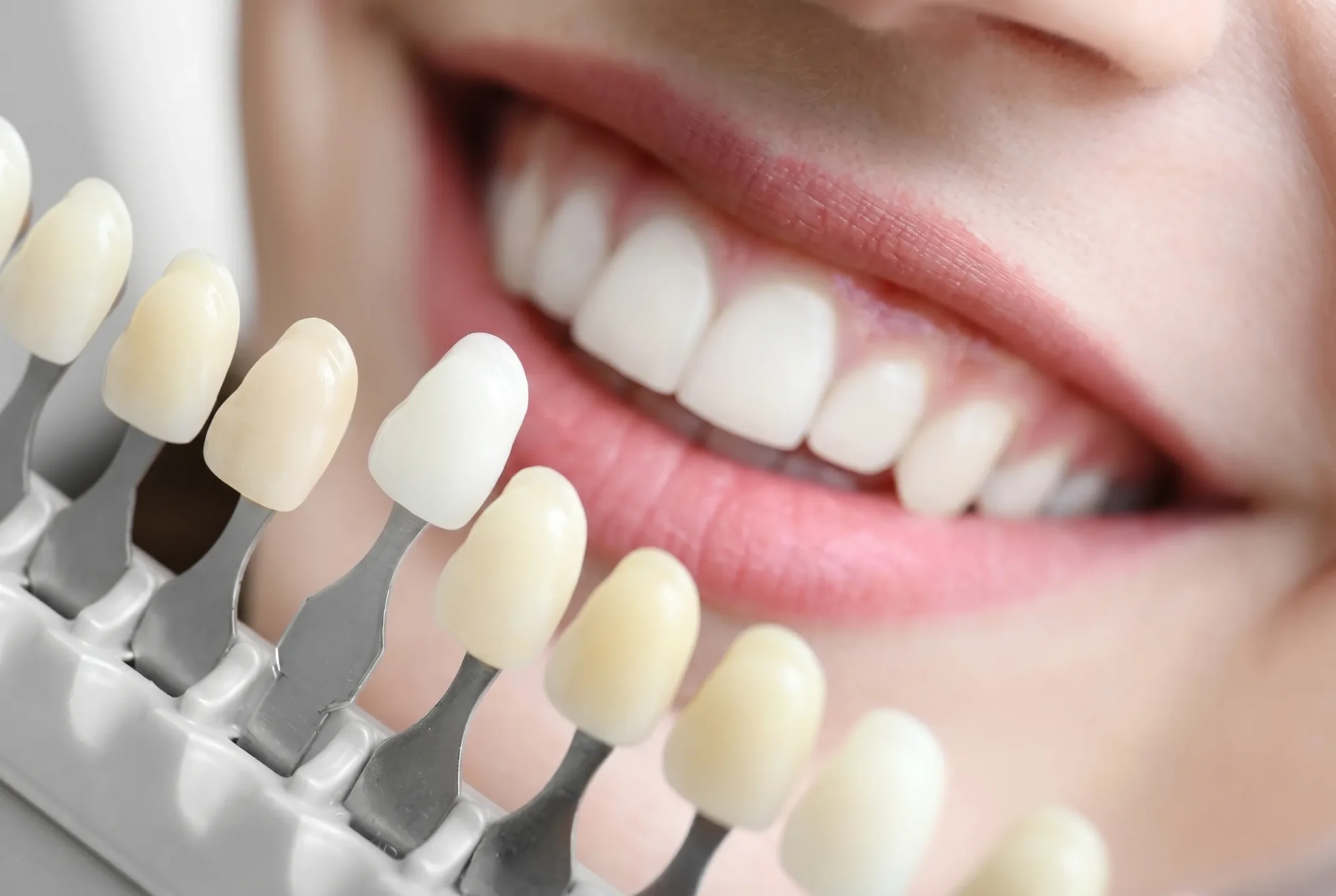 whitening2-2048x1374